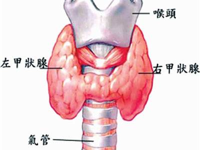 碘甲状腺功能亢进症