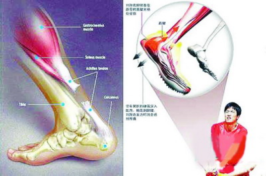 运动医学（医学与体育运动相结合的综合性应用科学）