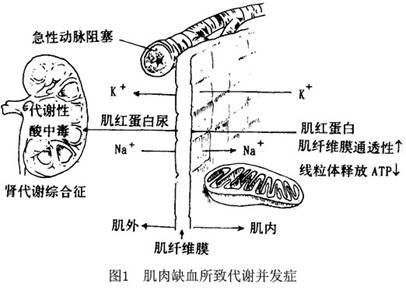 化学物质敏感综合症