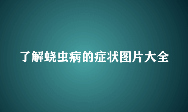 了解蛲虫病的症状图片大全