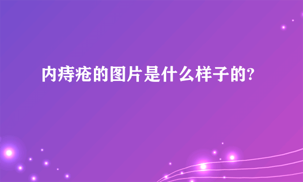 内痔疮的图片是什么样子的?