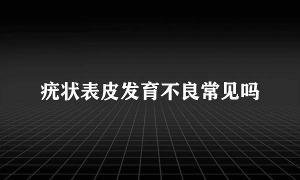 疣状表皮发育不良常见吗