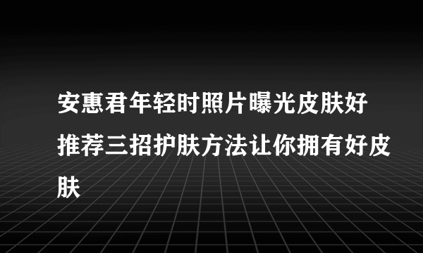 安惠君年轻时照片曝光皮肤好推荐三招护肤方法让你拥有好皮肤