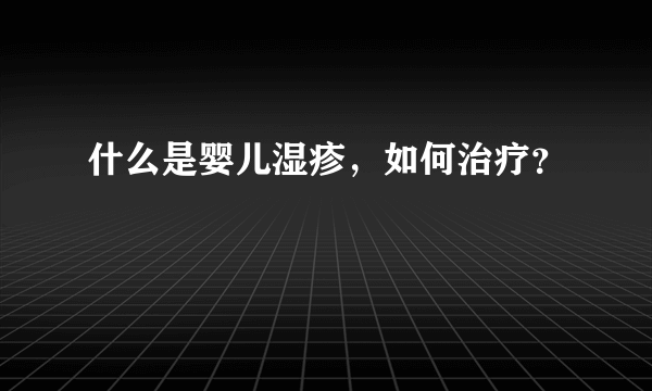 什么是婴儿湿疹，如何治疗？