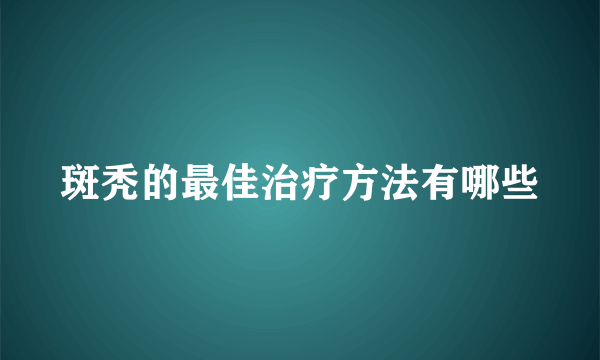 斑秃的最佳治疗方法有哪些