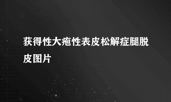 获得性大疱性表皮松解症腿脱皮图片