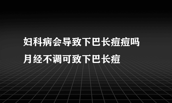 妇科病会导致下巴长痘痘吗 月经不调可致下巴长痘