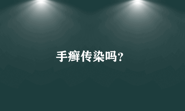 手癣传染吗？