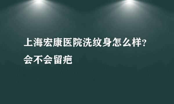 上海宏康医院洗纹身怎么样？会不会留疤