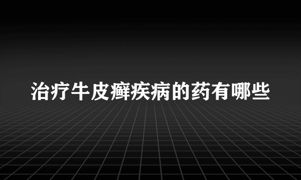 治疗牛皮癣疾病的药有哪些