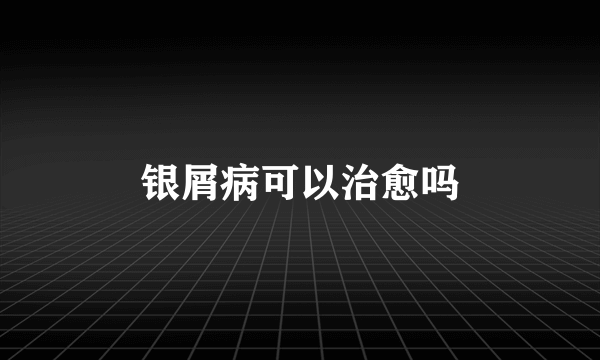 银屑病可以治愈吗