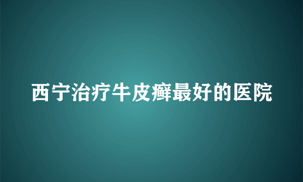 西宁治疗牛皮癣最好的医院