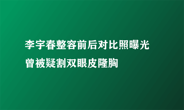 李宇春整容前后对比照曝光 曾被疑割双眼皮隆胸