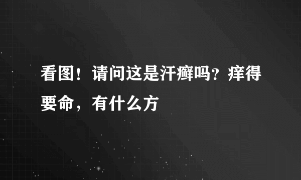 看图！请问这是汗癣吗？痒得要命，有什么方