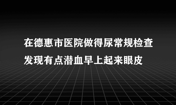 在德惠市医院做得尿常规检查发现有点潜血早上起来眼皮