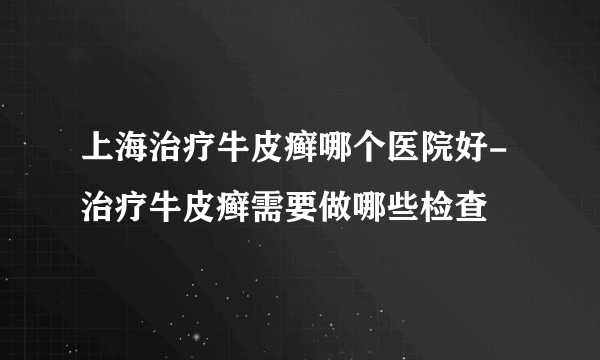 上海治疗牛皮癣哪个医院好-治疗牛皮癣需要做哪些检查