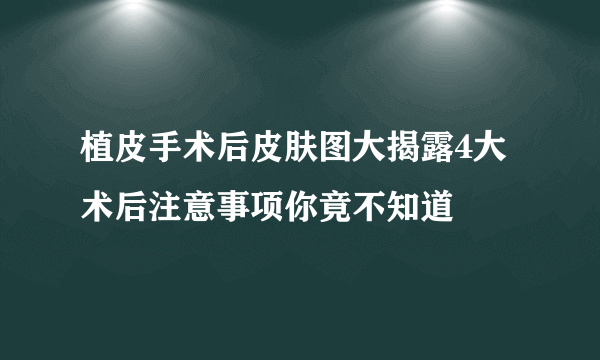 植皮手术后皮肤图大揭露4大术后注意事项你竟不知道