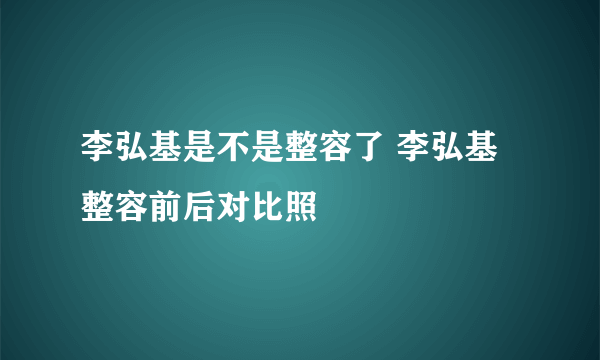 李弘基是不是整容了 李弘基整容前后对比照