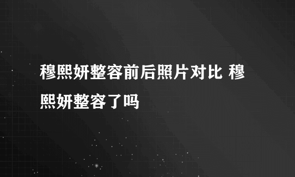 穆熙妍整容前后照片对比 穆熙妍整容了吗