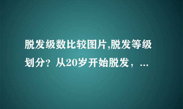 脱发级数比较图片,脱发等级划分？从20岁开始脱发，现在...