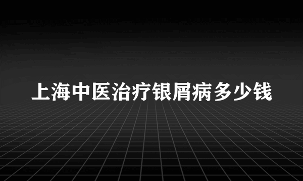 上海中医治疗银屑病多少钱