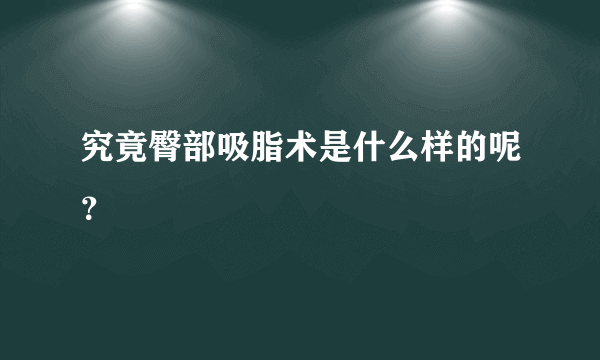 究竟臀部吸脂术是什么样的呢？