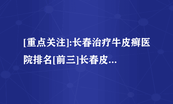 [重点关注]:长春治疗牛皮癣医院排名[前三]长春皮肤病医院「排名详情」