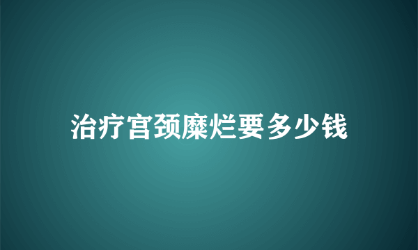 治疗宫颈糜烂要多少钱