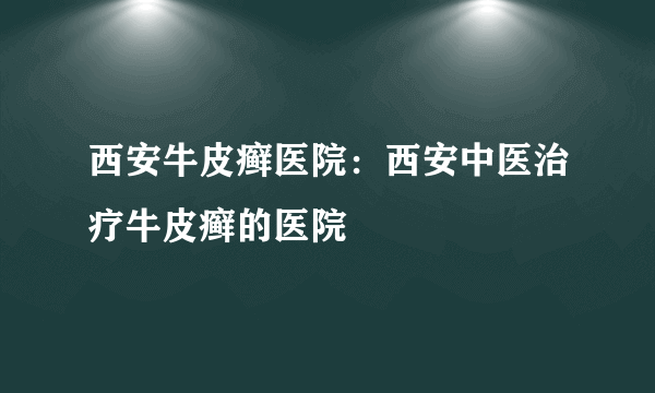 西安牛皮癣医院：西安中医治疗牛皮癣的医院