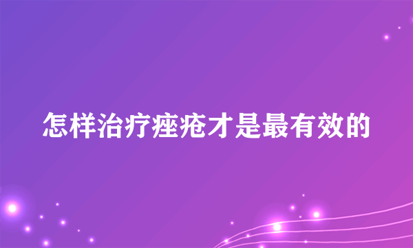 怎样治疗痤疮才是最有效的