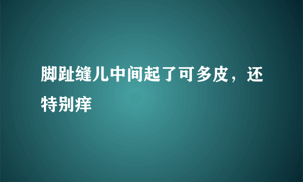 脚趾缝儿中间起了可多皮，还特别痒