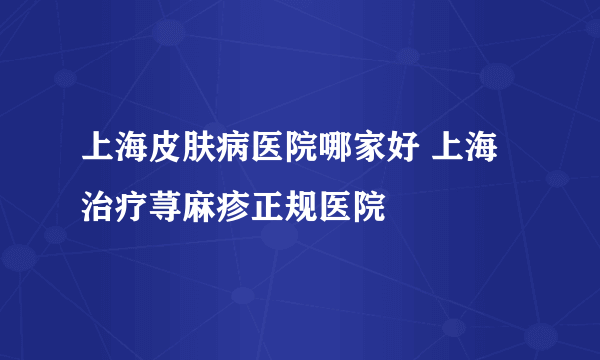 上海皮肤病医院哪家好 上海治疗荨麻疹正规医院