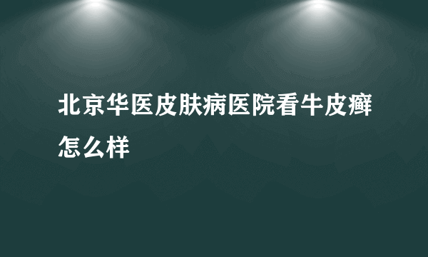 北京华医皮肤病医院看牛皮癣怎么样