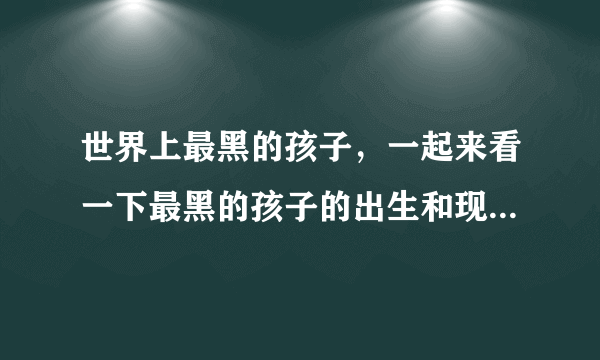 世界上最黑的孩子，一起来看一下最黑的孩子的出生和现状！ ... 