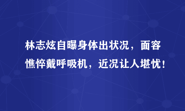 林志炫自曝身体出状况，面容憔悴戴呼吸机，近况让人堪忧！