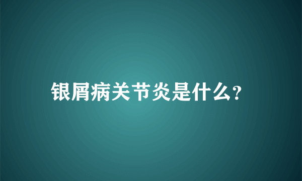 银屑病关节炎是什么？