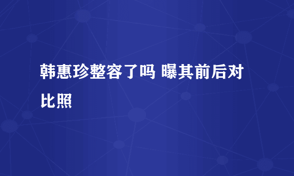 韩惠珍整容了吗 曝其前后对比照