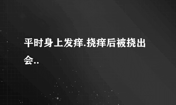 平时身上发痒.挠痒后被挠出会..