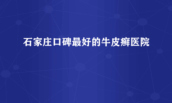 石家庄口碑最好的牛皮癣医院