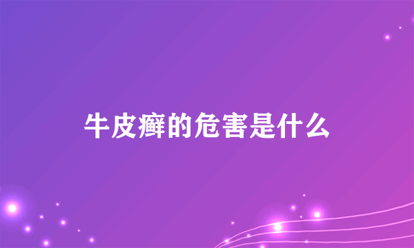 牛皮癣的危害是什么