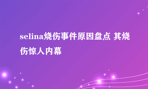 selina烧伤事件原因盘点 其烧伤惊人内幕