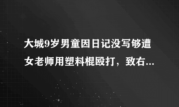 大城9岁男童因日记没写够遭女老师用塑料棍殴打，致右腿淤青肿胀，当地教育局：事件正在调查中，你怎么看？