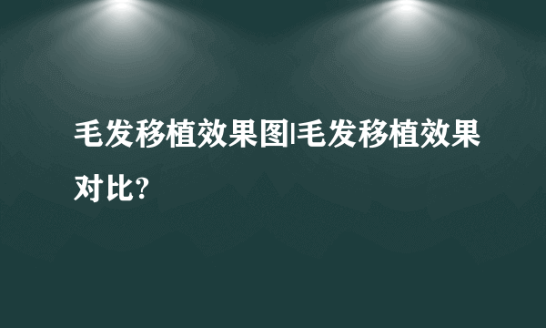 毛发移植效果图|毛发移植效果对比?